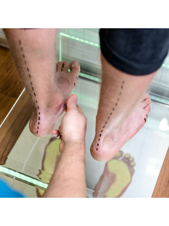 Podoscope - A diagnostic device that allows you to assess the shape of the foot