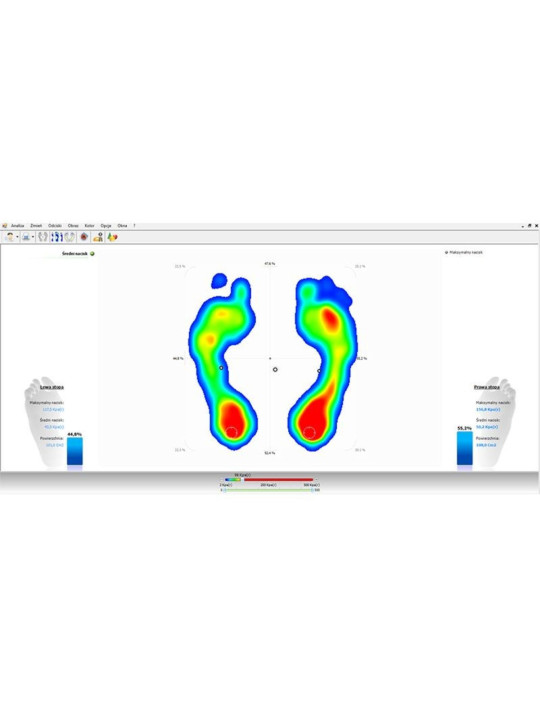 Подоскоп - діагностичний прилад, що дозволяє оцінити форму стопи Педобарограф E.P.S./R2