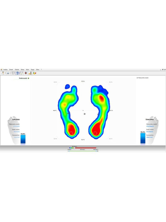 Podoscope – diagnosztikai eszköz, amely lehetővé teszi a láb alakjának felmérését. Pedobarograph E.P.S./R2