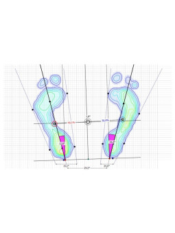 Podoscope - A diagnostic device allowing the assessment of the shape of the foot. Pedobarograph E.P.S./R2