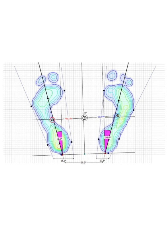 Podoscope - Diagnosztikai eszköz, amely lehetővé teszi a láb alakjának felmérését Pedobarograph E.P.S./R2