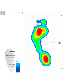 Podoscope - A diagnostic device allowing the assessment of the shape of the foot. Pedobarograph E.P.S./R2