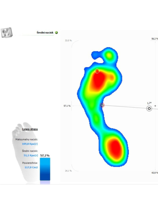 Podoscope - Diagnosztikai eszköz, amely lehetővé teszi a láb alakjának felmérését Pedobarograph E.P.S./R2