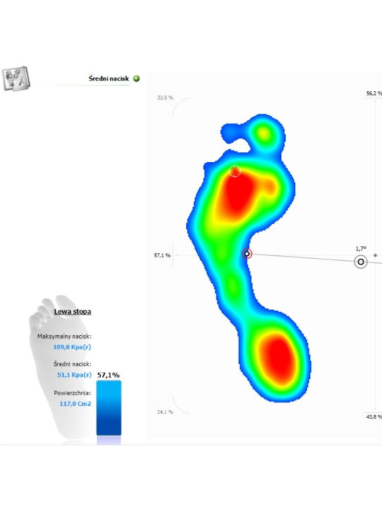 Podoskop - Urządzenie diagnostyczne pozwalające na ocenę kształtu stopy Pedobarograf E.P.S./R2