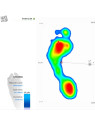 Подоскоп - діагностичний прилад, що дозволяє оцінити форму стопи Педобарограф E.P.S./R2