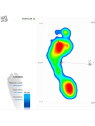 Podoscop - Dispozitiv diagnostic pentru evaluarea formei piciorului Pedobarograf E.P.S./R2