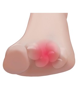 FRESCO PURE GEL TOE PROPS Podložka pod prsty pro deformaci kladívkového prstu velikost L 1 pár