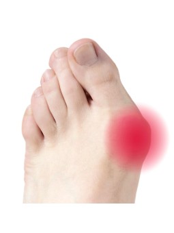 FRESCO PURE GEL BUNION Żelowy ochraniacz na haluksy roz. Uniwersalny 6 szt.